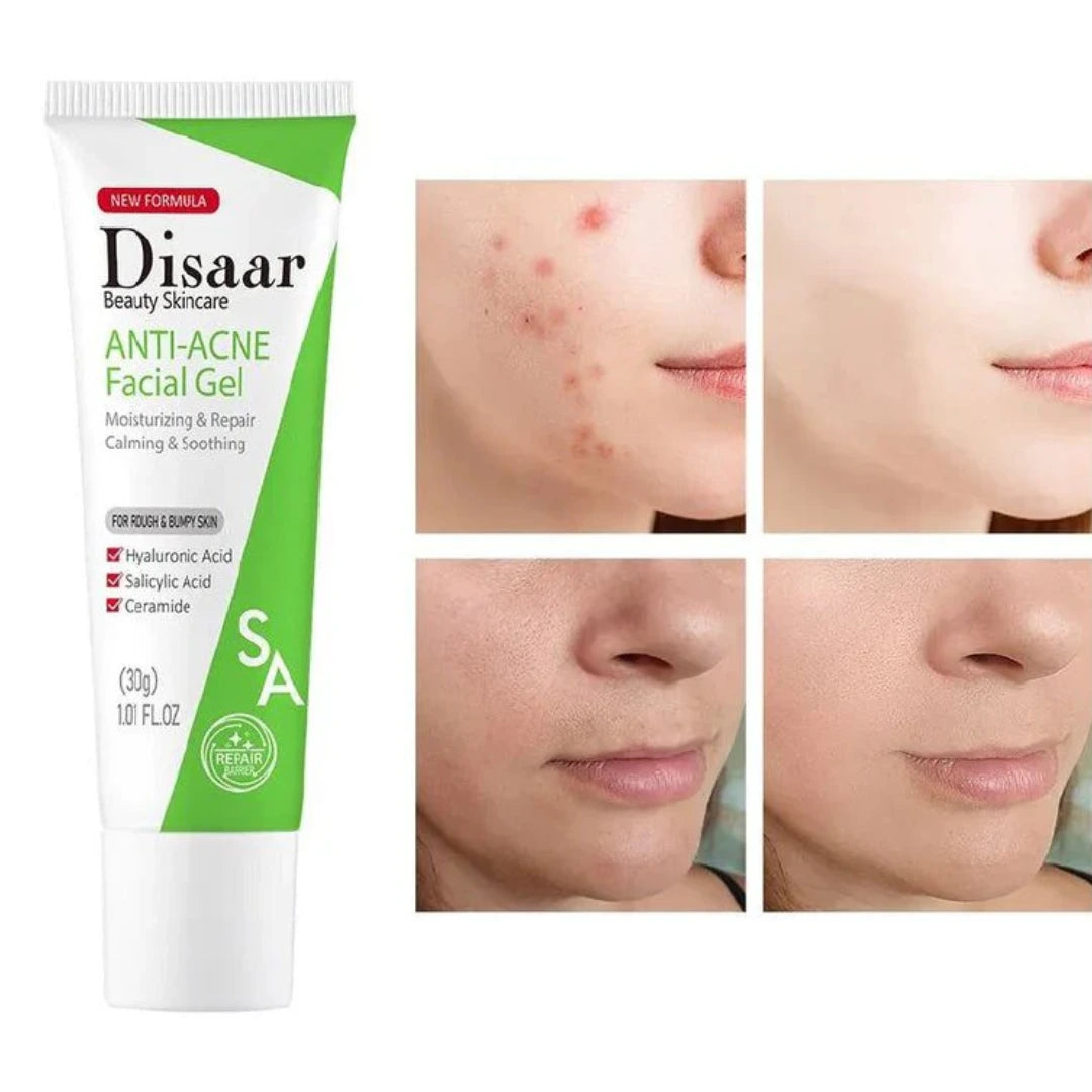 Gel Anti-acné Con Acido Salicílico❤️